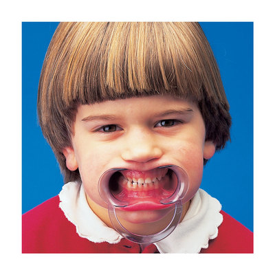 Spandex Child Pk/2 Two-Sided Lip and Cheek Retractor