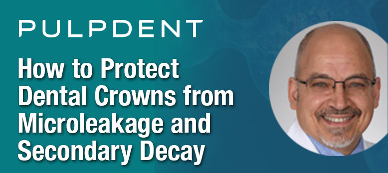 How to Protect Dental Crowns from Microleakage and Secondary Decay